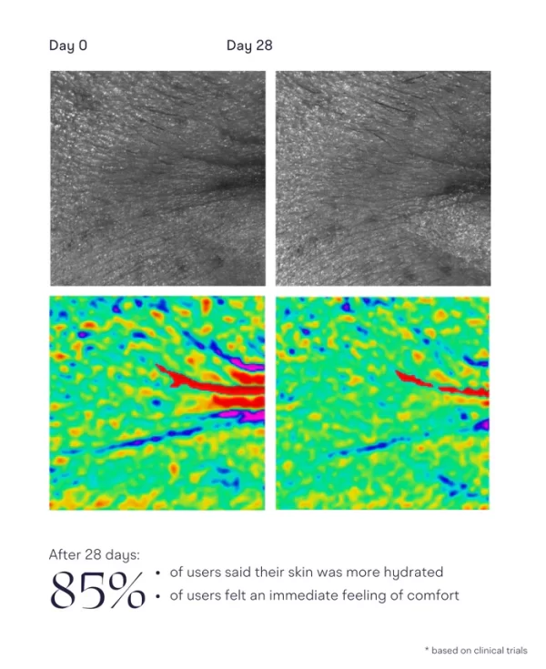 Eye Love You Starter Kit